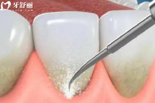 焦作靠谱牙科排名 焦作靠谱牙科排名