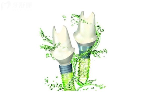 常州佧瓦口腔种植牙怎么样?资质 / 价格 / 优势 / 医生全攻略 常州佧瓦口腔种植牙怎么样?资质 / 价格 / 优势 / 医生全攻略