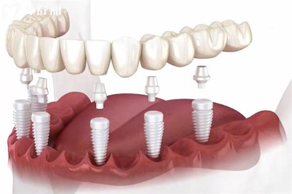 兰州天牙口腔门诊部在哪里?位于平凉路429号/是西部大型连锁口腔/技术正规可靠 兰州天牙口腔门诊部在哪里?位于平凉路429号/是西部大型连锁口腔/技术正规可靠