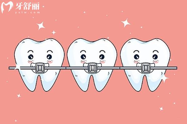 杭州正规牙科医院收费价目表 杭州正规牙科医院收费价目表