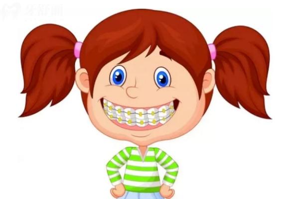 戴牙套如何避免口腔溃疡?这些保护神器必备 戴牙套如何避免口腔溃疡?这些保护神器必备