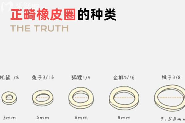 1761895086674230.jpg 正畸橡皮圈.jpg