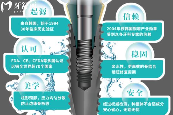 韩国科威尔种植牙怎么样 韩国科威尔种植牙怎么样