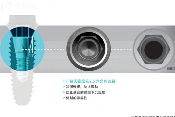 韩国科威尔种植牙怎么样 韩国科威尔种植牙怎么样