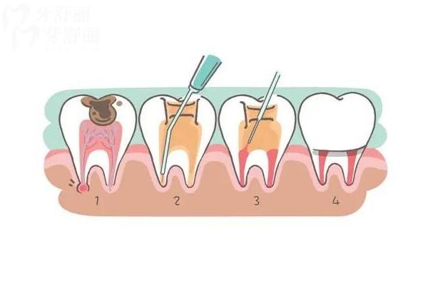 眉山正好口腔2026价目表:补牙/拔牙/种植牙等项目收费公开,地址 眉山正好口腔2026价目表:补牙/拔牙/种植牙等项目收费公开,地址
