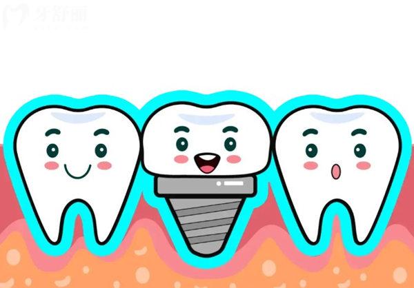 种植牙整个流程下来得多久?即刻完成或3-6个月,根据牙槽骨情况而定 种植牙整个流程下来得多久?即刻完成或3-6个月,根据牙槽骨情况而定