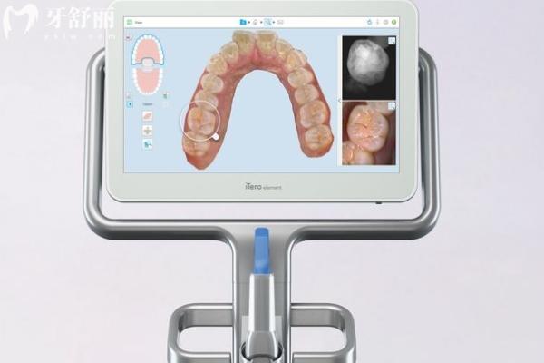 数字化正畸 (2).jpg