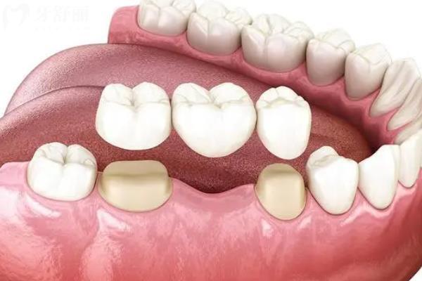 宝鸡牙科医院排名