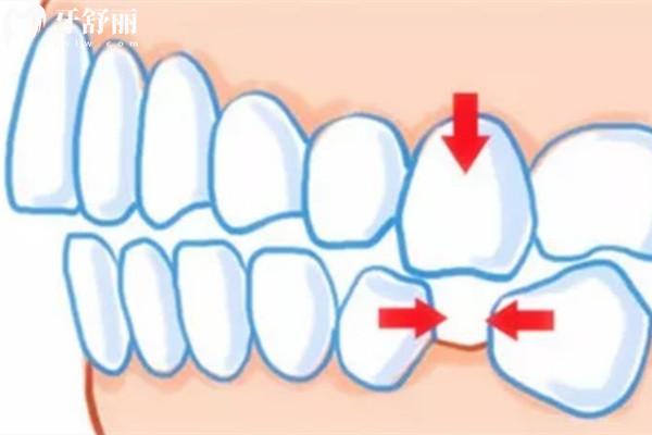 临汾中诺口腔医院收费标准