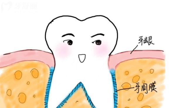 重度牙周病怎么治疗