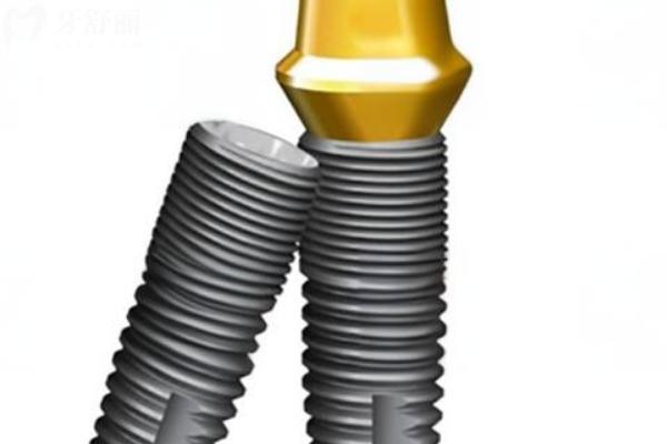 瑞士SIC和ITI种植体哪个好