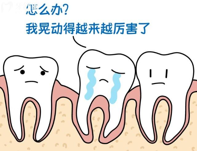 如何判断牙齿松动的一二三度?3分钟带你了解牙齿松动等级及治疗方案