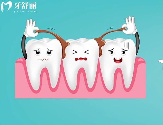如何判断牙齿松动的一二三度?3分钟带你了解牙齿松动等级及治疗方案
