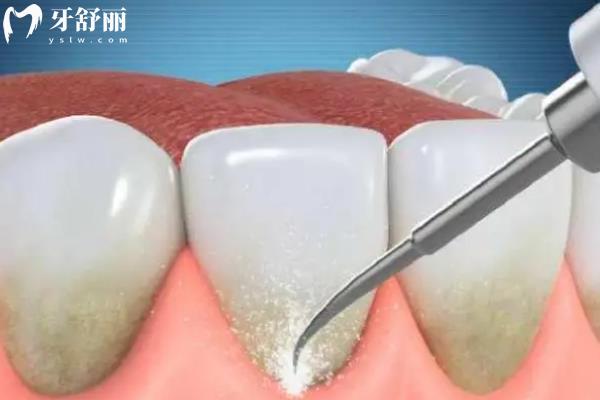 桐乡牙科医院哪一家口碑高