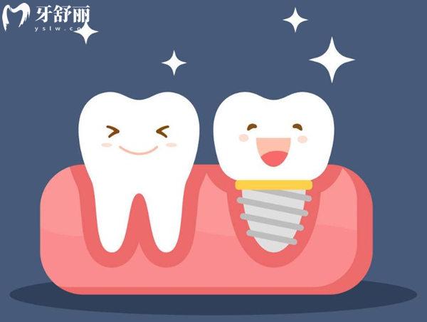 瑞士种植牙品牌有哪些?排名前五的士卓曼