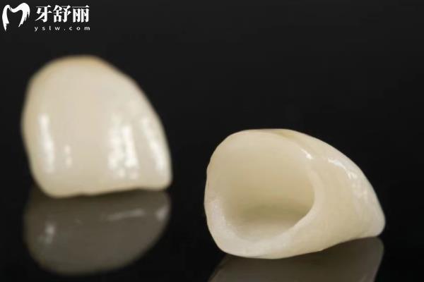 威兰德臻瓷VS全瓷