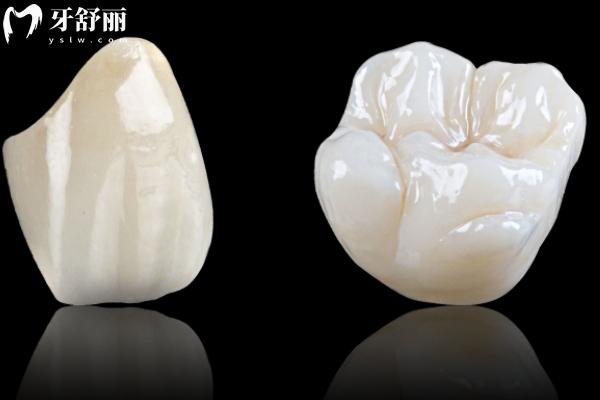 威兰德臻瓷VS全瓷