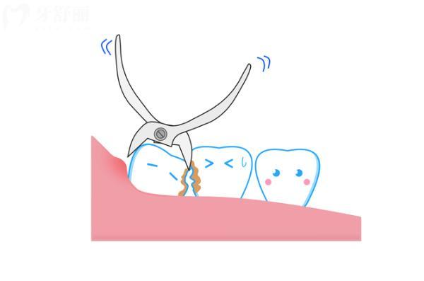 牙齿坏了牙根留着好还是拔了好？一直不处理会怎么样