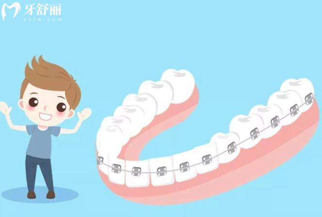 成都牙齿矫正哪家医院比较好?求推荐性价比高的医院