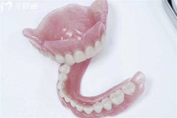 舒士德吸附性义齿1.jpg