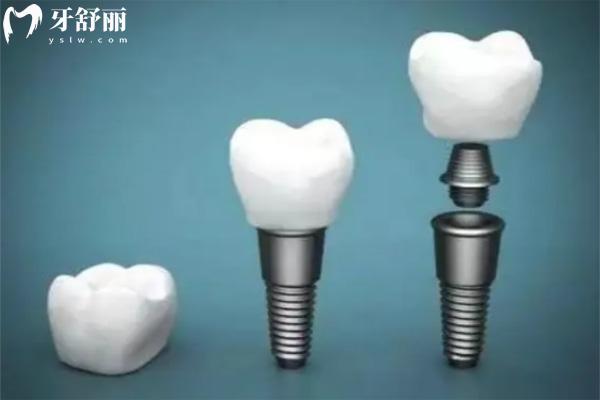 26西宁中诺口腔价格表上新