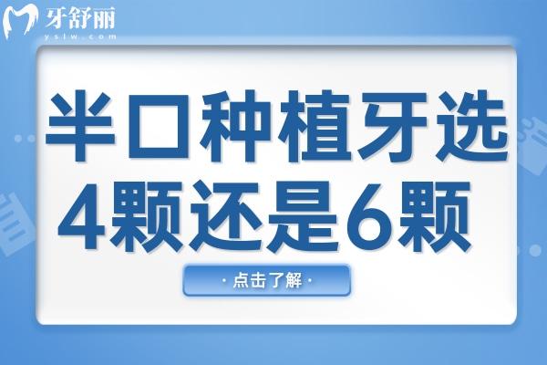 纠结半口种植牙选4颗还是6颗？除了价格和数量不同外，稳定性与耐用性也不同