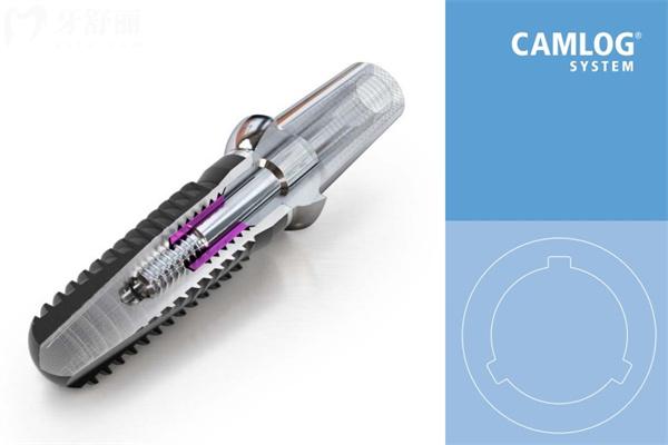 德国camlog种植体01.jpg