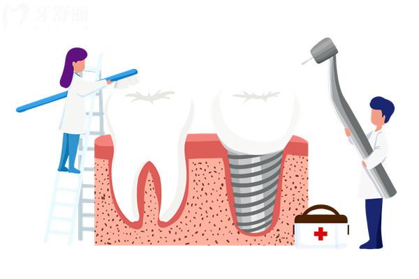 士卓曼种植体亲水系列有几种？