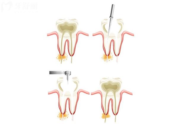 九江口腔医院2026新收费标准曝光:种植牙2800+矫正6800+牙齿美白1000+