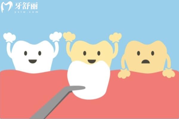 深圳牙齿贴片医院哪家好