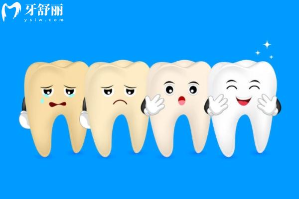 牙齿美白能提升几个色阶