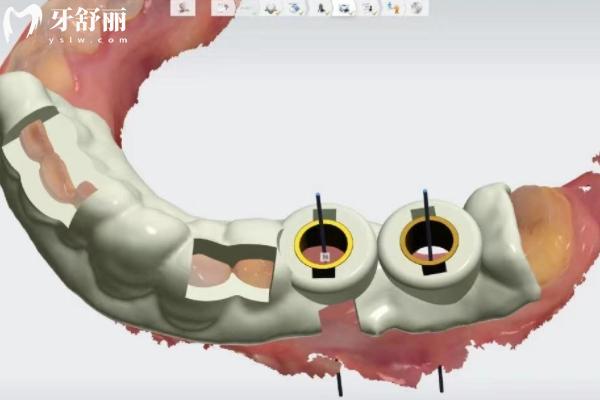 26年新版龙口牙科收费价目表
