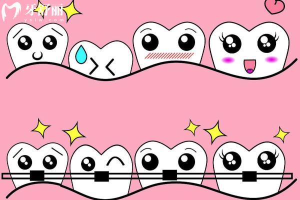 牙齿坏了怎么办