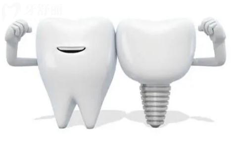 北京朝阳区种植牙医院哪家好