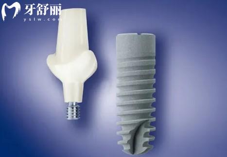 北京朝阳区种牙医院排行榜