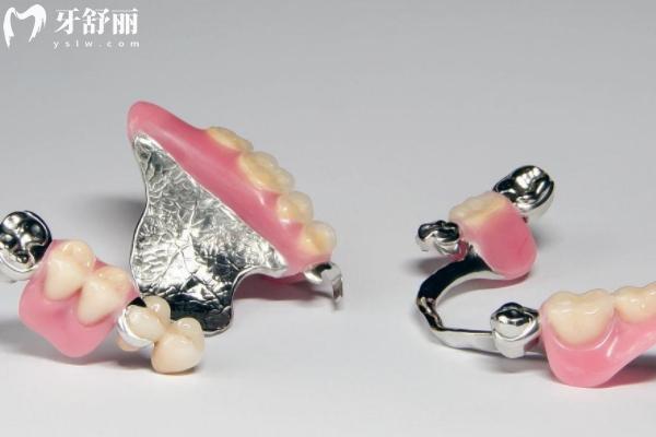 活动牙支架的材料都有哪些