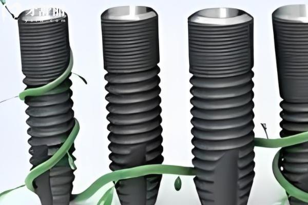 瑞典astra种植体好不好