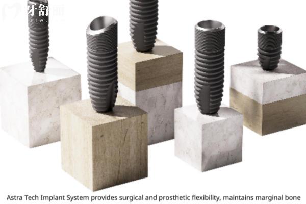 瑞典astra种植体好不好