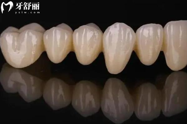 2026宁波象山丹山口腔医院价格表，种植牙2880元起+矫正7980元起等附地址