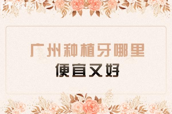 广州种植牙哪里便宜又好？