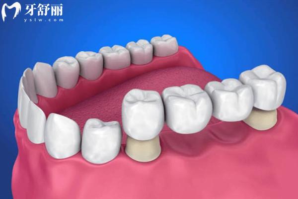 2026宁波拜博口腔收费标准&医生介绍上线,种植牙1850起,正畸/全瓷牙价格明细速存