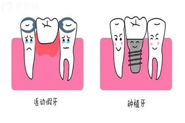 西安哪个地方镶全口假牙好?