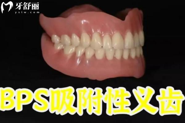 2026年活动假牙价格一览表