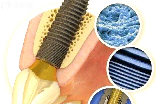 2026贵港口腔医院收费价目表