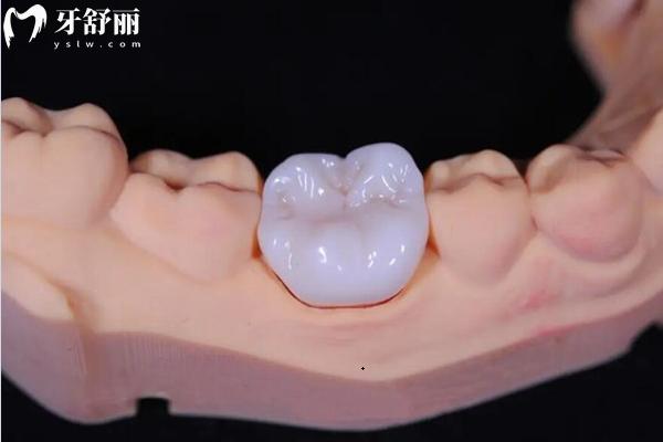 淮安牙院仕口腔医院看牙贵吗？矫正8800+种牙1980+补牙180+等性价比不错