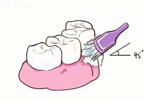 电动牙刷需要额外用巴氏刷牙法吗？你可能一直用错了