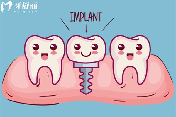 市场上高端种植体有哪些品牌？