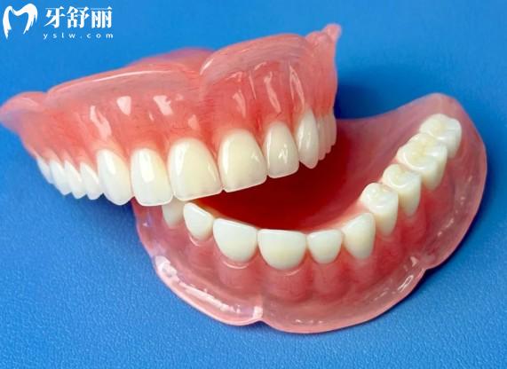 【老人镶牙的材料及价格表全攻略】钛合金/全瓷牙/种植牙/吸附性义齿，这些材质你pick哪个？