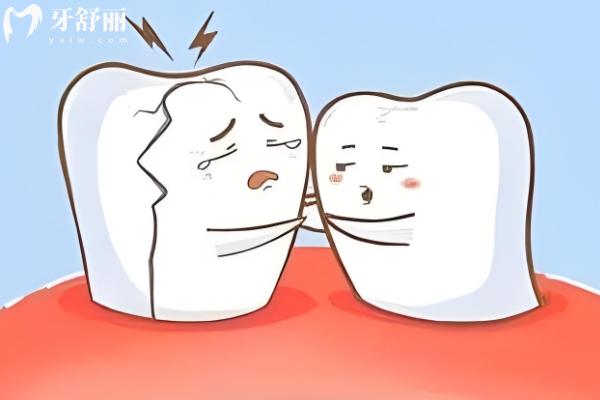 已经隐裂的牙齿能自愈吗？