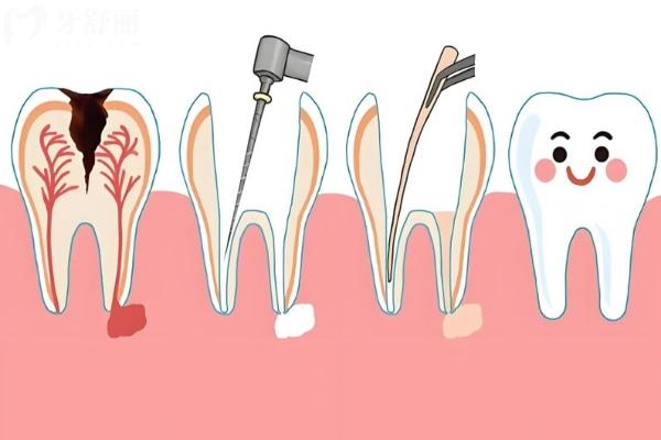 市民推荐岳阳种植牙医院排名及价格表曝光